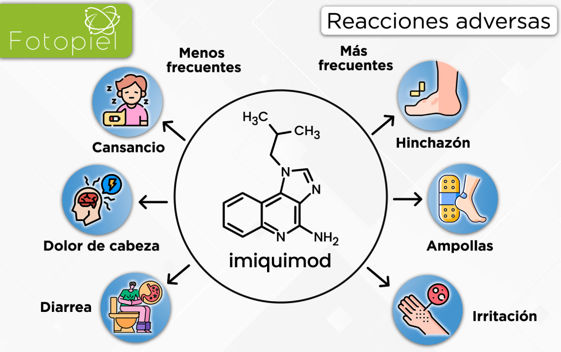 Imiquimod En España
