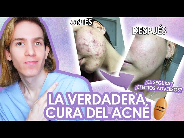 Accutane pastillas precio
