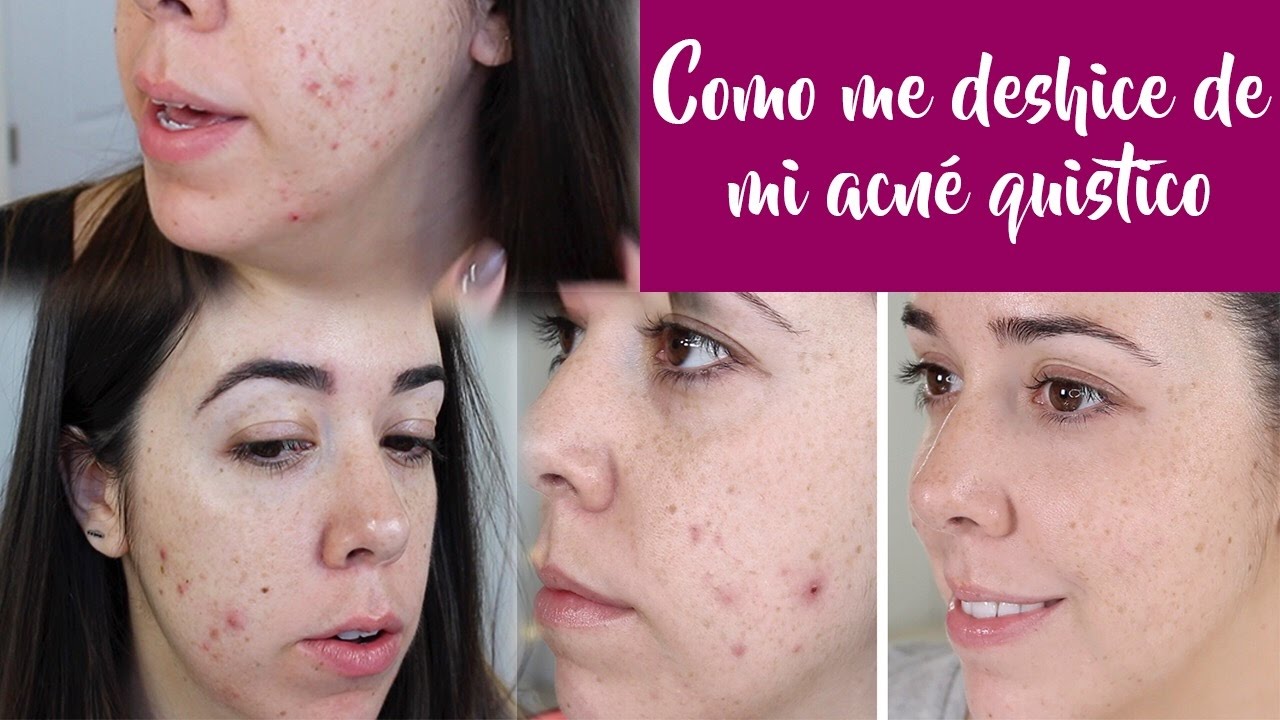 Roacutan Donde Lo Venden