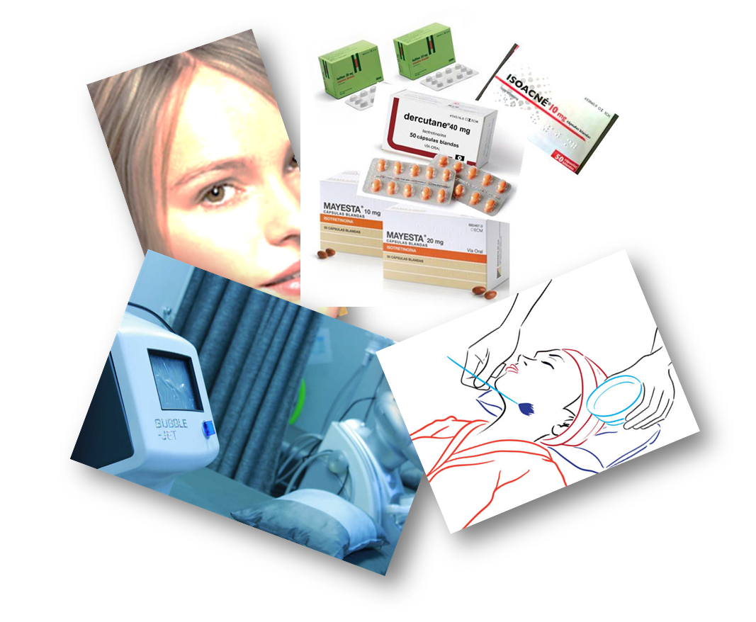 Ordenar Isotretinoina En Línea