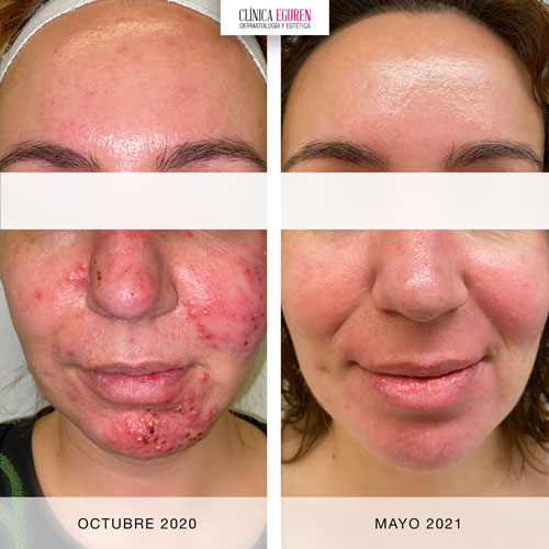 Donde Venden El Roacutan