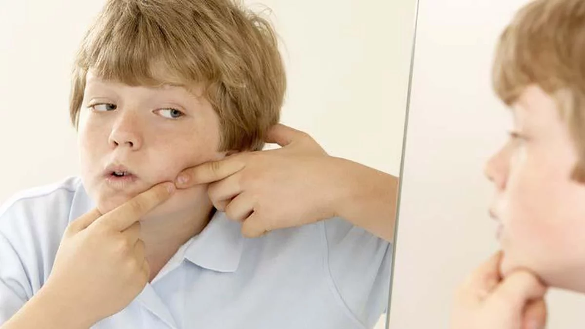 Isotretinoin Pastillas