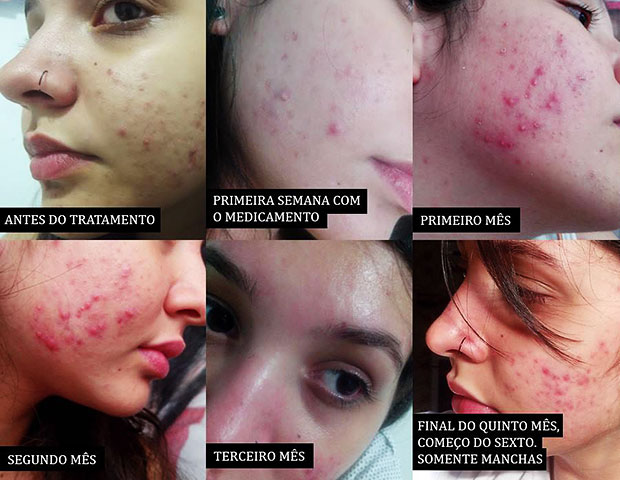 Preco De Um Roacutan