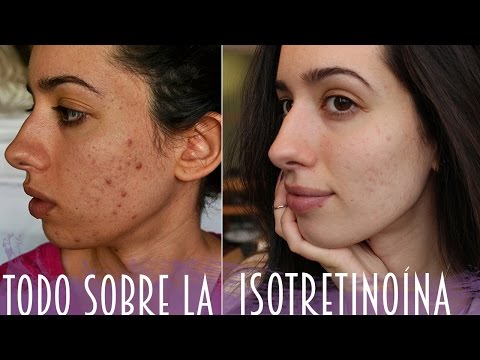 Precio De Roacutan En España