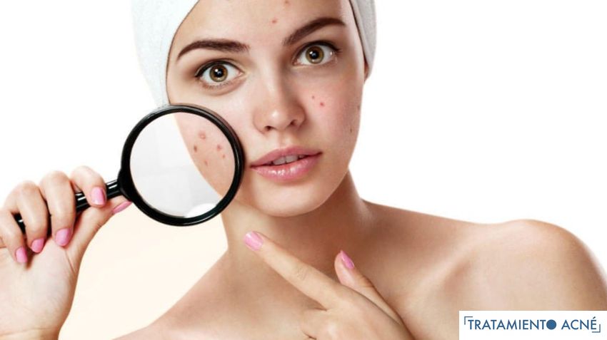 accutane cómo comprar