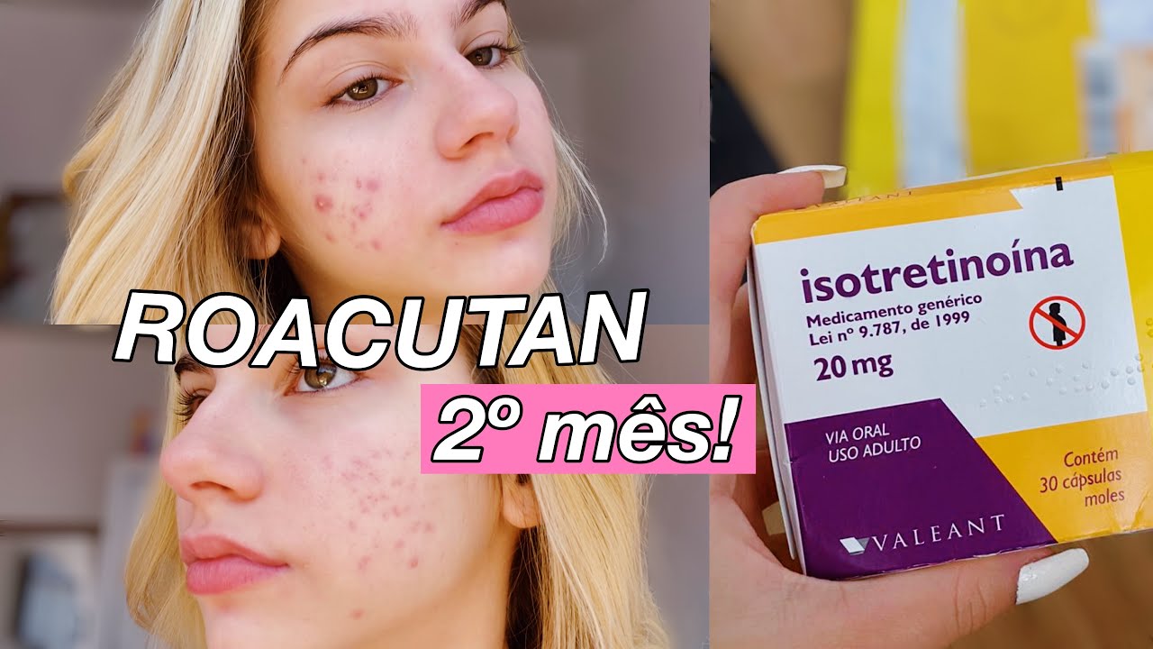 Isotretinoina genéricos