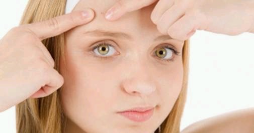 Roaccutane pastillas