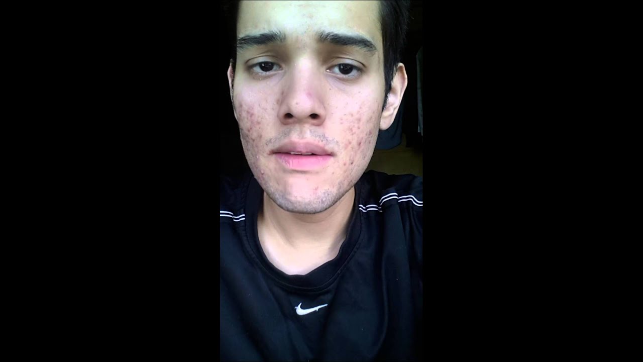 Precio Del Roacutan En España