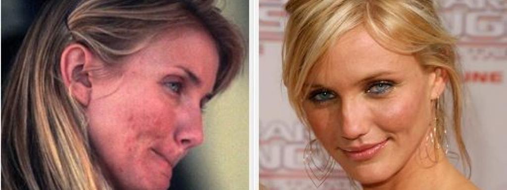 Medicamento Roacutan Pastillas