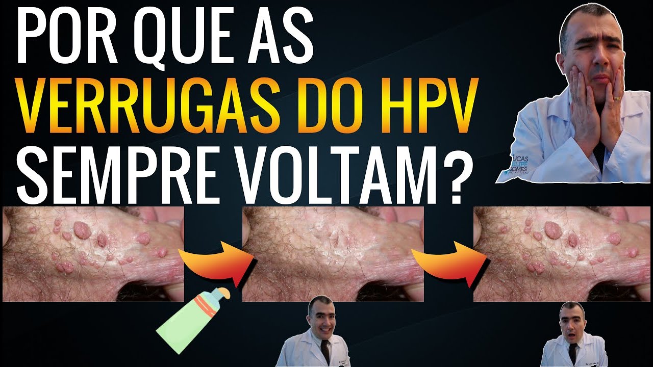 Comprar ixium imiquimod