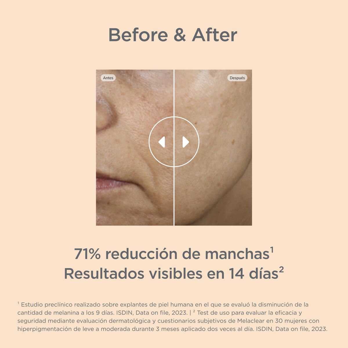 donde comprar isotretinoina en mexico