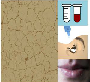 Pastillas granos roacutan