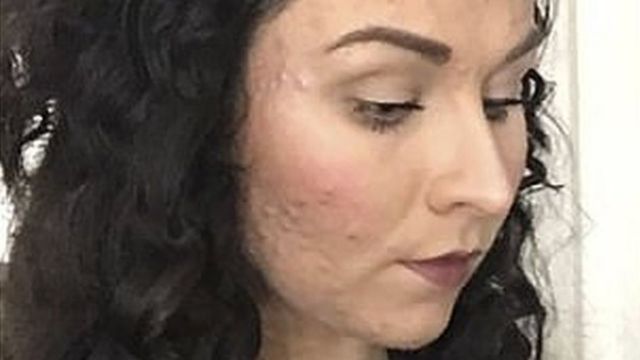 Precio Pastillas Roacutan