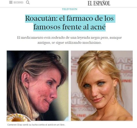 roacutan capsulas precio